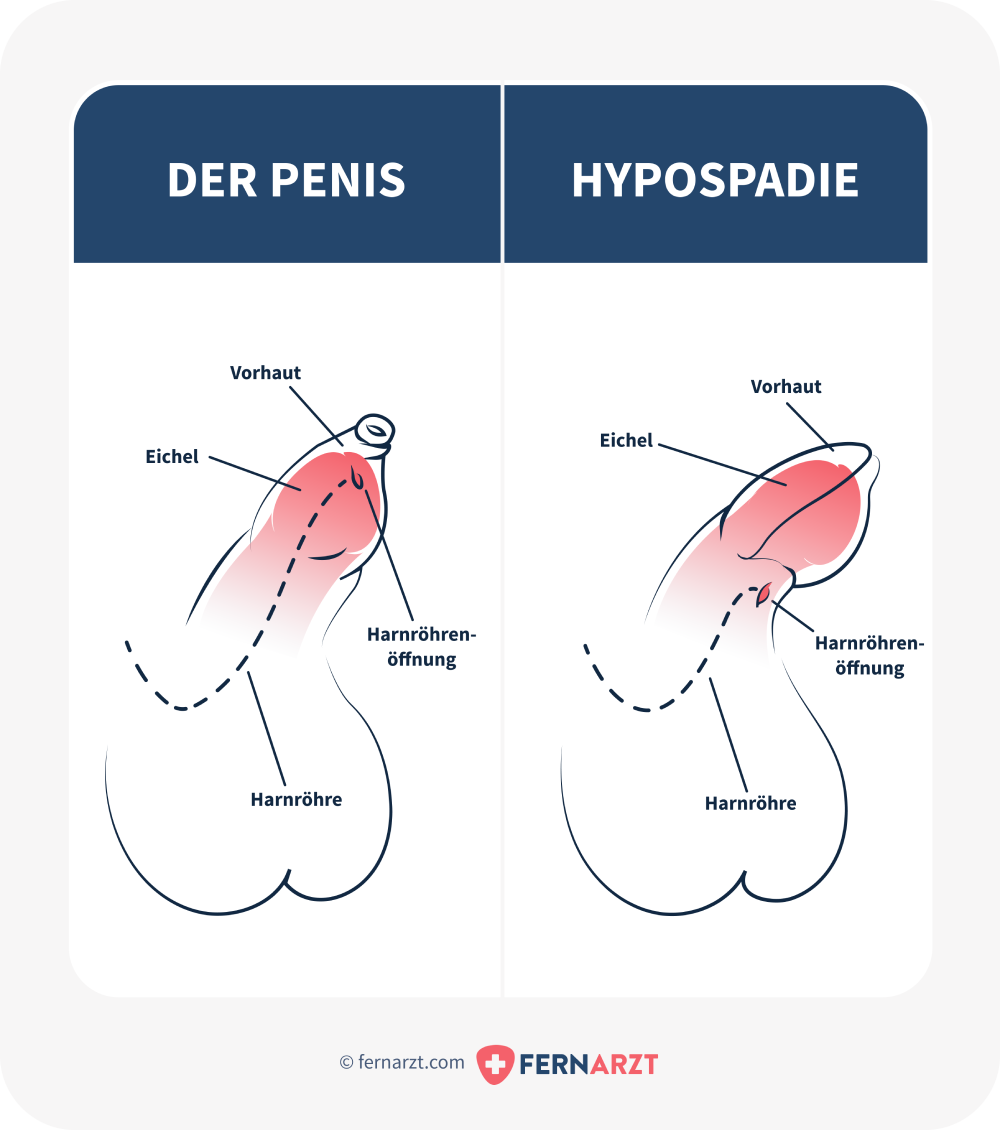 penis befriedigung Masturbation – Wikipedia main image 1