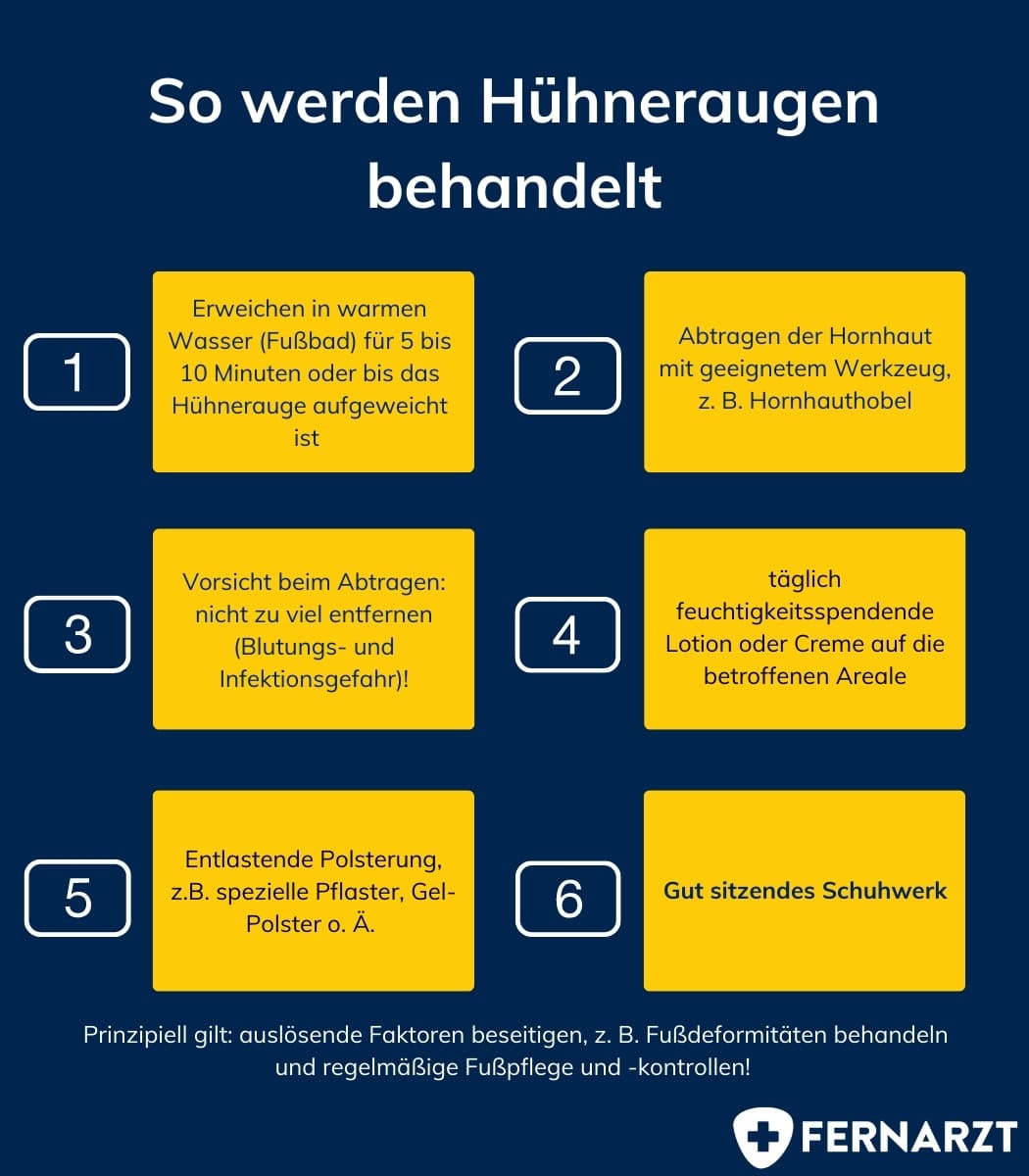 So werden Hühneraugen behandelt.