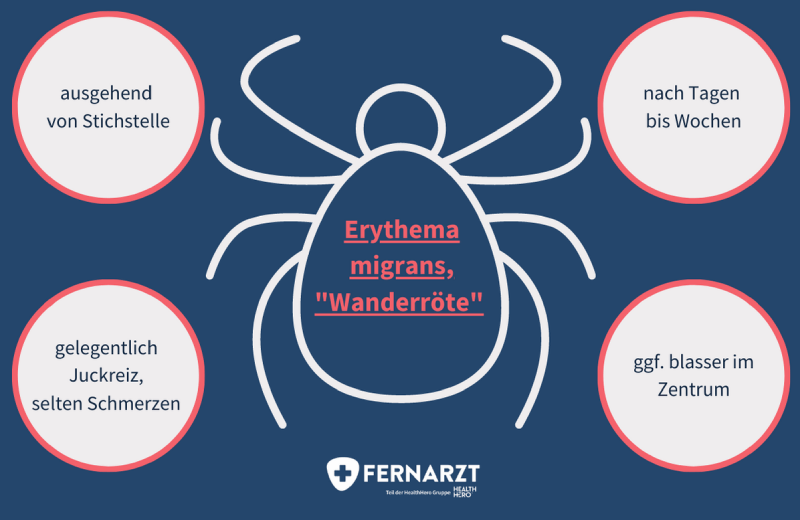 Anzeichen zur Identifikation von Wanderröte (Erythema migrans) nach einem Zeckenstich. Dies ist ein Hinweis auf Lyme-Berreliose.