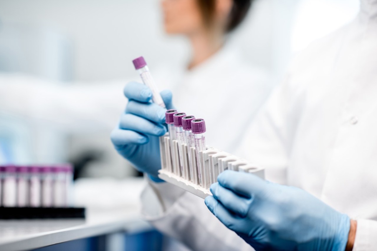 Reagenzgläser und Teströhrchen mit Blut im Labor für Coronatest.