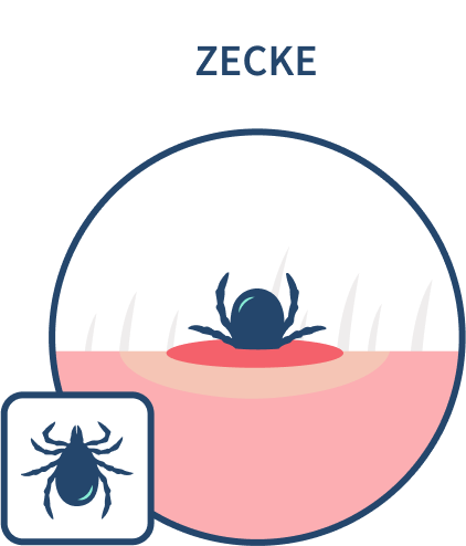 Schematische Darstellung einer Zecke und eines Zechenstiches.
