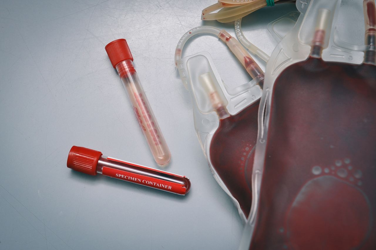 Blutspende: Blutkonserve oder Blutbeutel und Blutproben in Röhrchen. Vollblut, Erythrozyten, Thrombozyten.