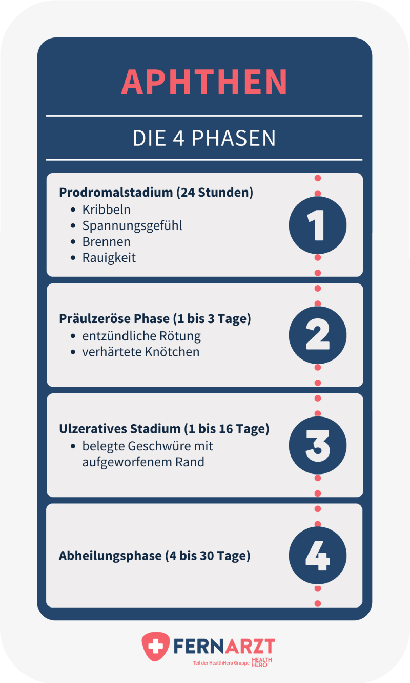 Die vier Phasen einer Aphthosis: Prodromalstadium, Präulzeröse Phase, Ulzeratives Stadium, Abheilungsphase