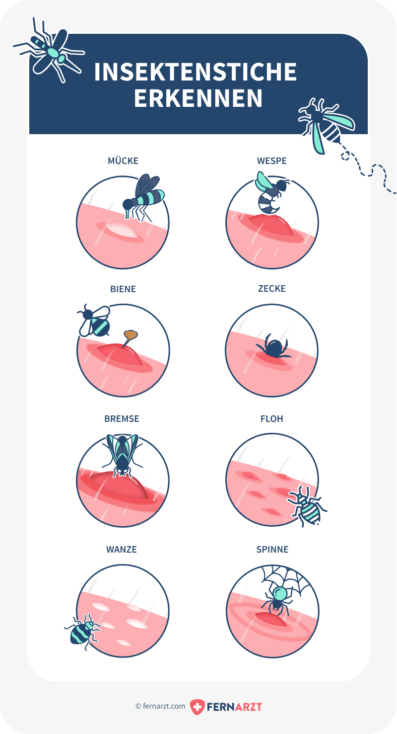 Infografik: Verschiedene Insektenstiche. Mücke, Wespe, Biene, Zecke, Bremse, Floh, Wanze, Spinne.