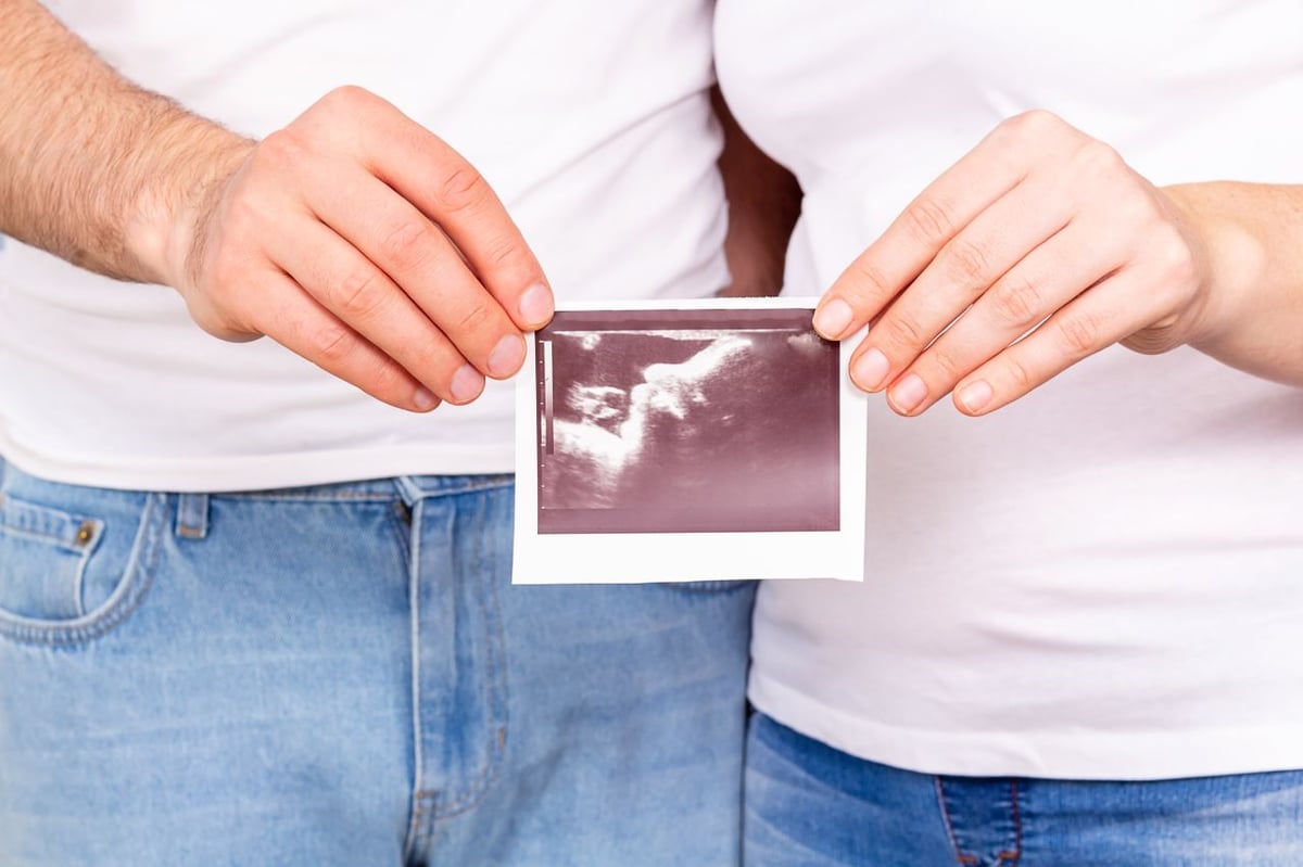 Mann und Frau stehen nebeneinander. Sie halten gemeinsam ein Ultraschallbild hoch.