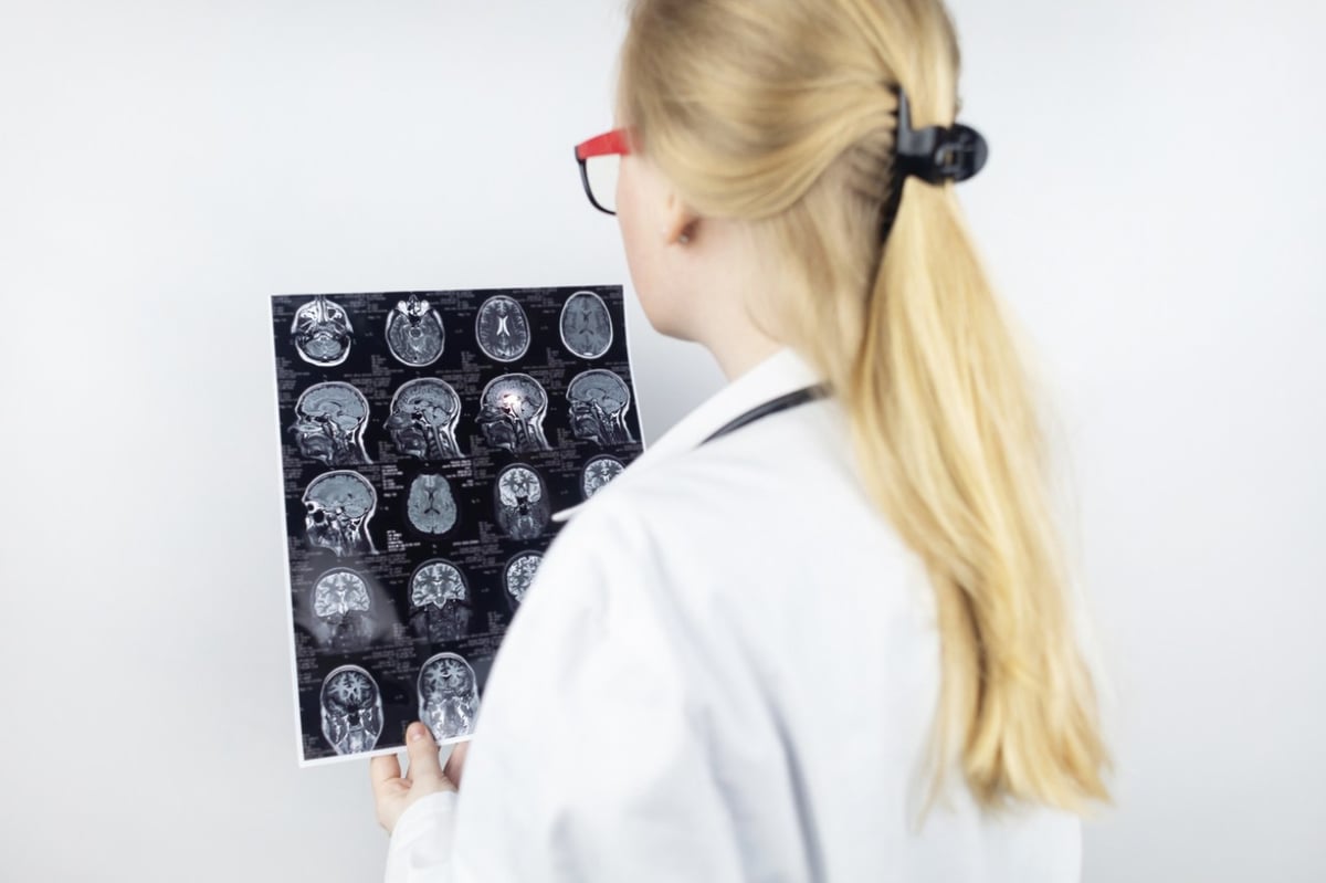 Ärztin begutachtet MRT Bilder eines Patienten mit Multipler Sklerose.