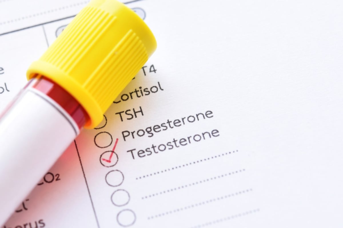 Auf einem Anforderungsschein für das Labor ist der Testosteron-Test ausgewählt.
