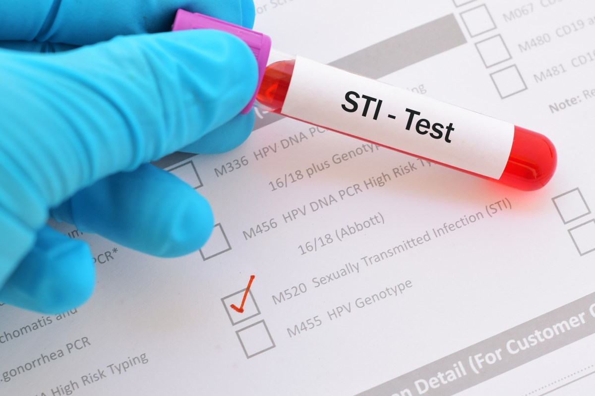 Labor Hand mit Handschuh hält Blutprobe im Röhrchen, dieses ist beschriftet mit STI-Test.