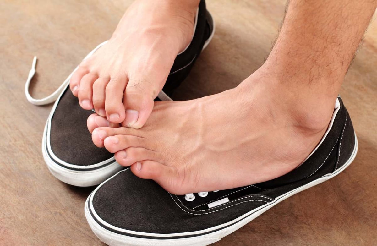 Fußpilz (Tinea pedis): Nackte Füße stehen auf einem paar Schuhe, die Zehen jucken vom Fußpilz.