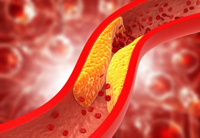 Cholesterin