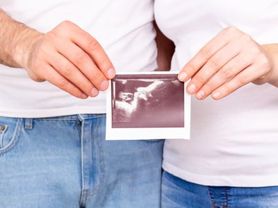 Mann und Frau stehen nebeneinander. Sie halten gemeinsam ein Ultraschallbild hoch.