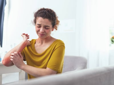 Histaminintoleranz: Junge Frau kratzt sich am Arm, der Arm ist schon rot vom vielen Kratzen.