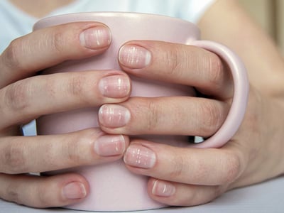 Hände mit weißen Flecken auf den Fingernägeln halten eine Tasse.