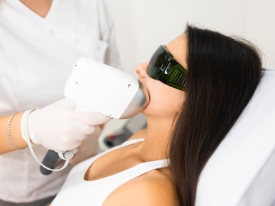 Eine Frau lässt sich mittels Lasertherapie den Damenbart entfernen.