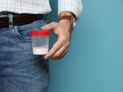 Ein Mann hält eine Samenspende oder Spermaprobe in einem Becher.