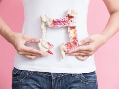 Frau hält Darmmodell vor dem Bauch