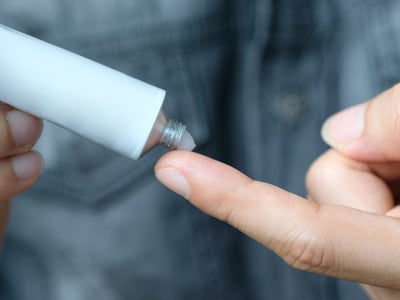 Ein Mann drückt Salbe aus einer Tube auf seine Fingerspitze.