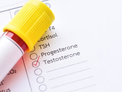 Auf einem Anforderungsschein für das Labor ist der Testosteron-Test ausgewählt.