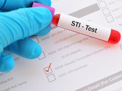 Labor Hand mit Handschuh hält Blutprobe im Röhrchen, dieses ist beschriftet mit STI-Test.