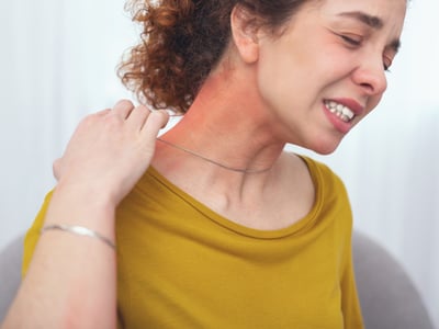 Junge Frau reagiert allergisch auf Kette. Schmuck mit Nickel kann Kontaktekzeme auslösen.