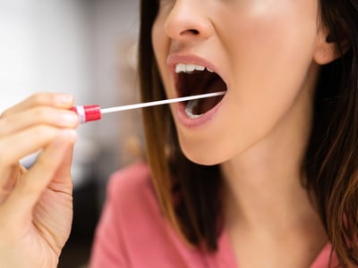 Frau macht mit Stäbchen einen Wangenabstrich. Aus dem biologischen Material kann eine Typisierung für Stammzellspenden erfolgen.