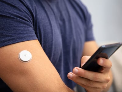 Auf dem Oberarm eines Mannes klebt ein Messgerät, welches auf dem Smartphone den Blutzuckerspiegel zeigen kann.