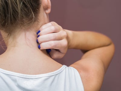 Frau kratz sich im Nacken. Jucken und Rötungen können durch Neurodermitis verursacht werden.