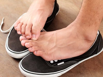 Fußpilz (Tinea pedis): Nackte Füße stehen auf einem paar Schuhe, die Zehen jucken vom Fußpilz.