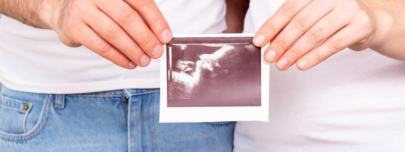 Mann und Frau stehen nebeneinander. Sie halten gemeinsam ein Ultraschallbild hoch.
