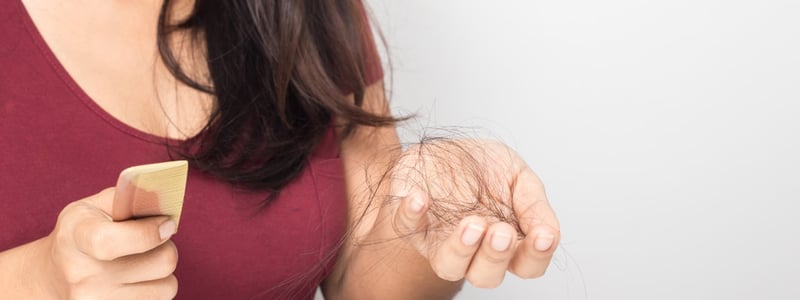 Frau mit Haarausfall, hält Kamm und Haare in der Hand.