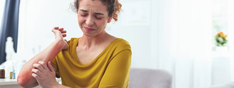 Histaminintoleranz: Junge Frau kratzt sich am Arm, der Arm ist schon rot vom vielen Kratzen.