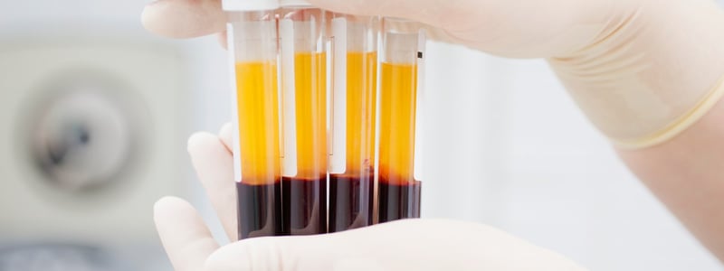 Blutproben getrennt in Blutserum und Blutzellen.