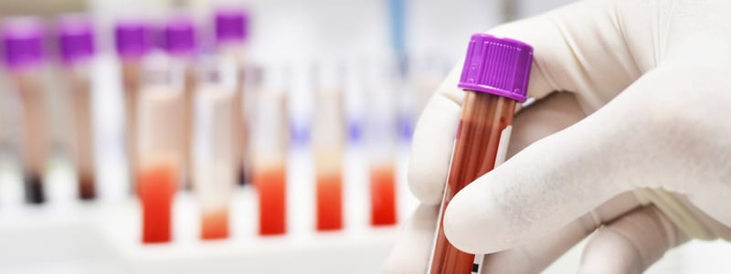 Probenröhrchen mit Blut zur Analyse im Labor.