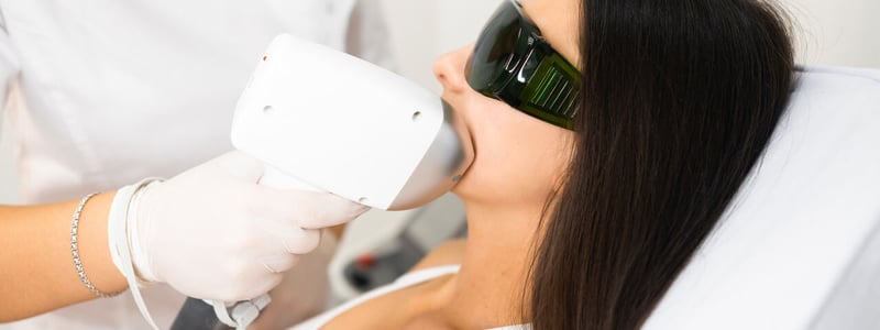 Eine Frau lässt sich mittels Lasertherapie den Damenbart entfernen.