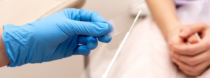 Frau sitz in gynäkologischer Praxis. Abstrich wird auf einen Objektträger aufgetragen.