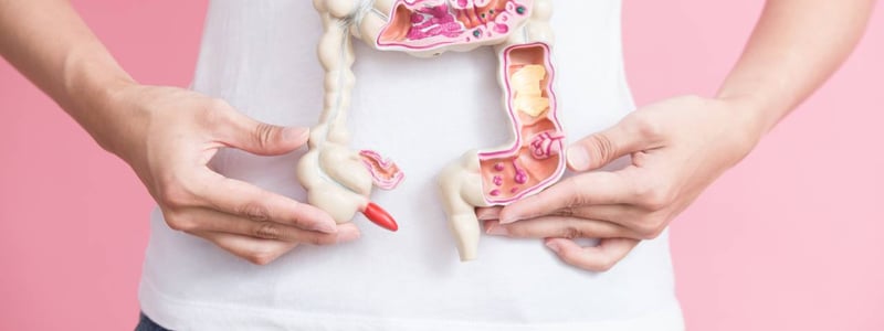 Frau hält Darmmodell vor dem Bauch