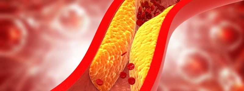 Grafische Darstellung von Blutgefäßen mit Ablagerung zur zu hohe Cholesterinspiegel. 