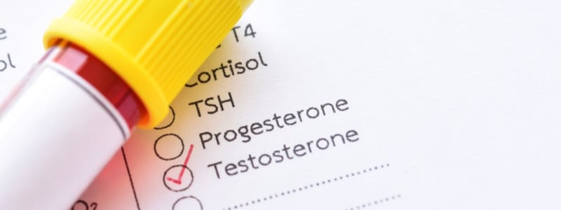 Auf einem Anforderungsschein für das Labor ist der Testosteron-Test ausgewählt.