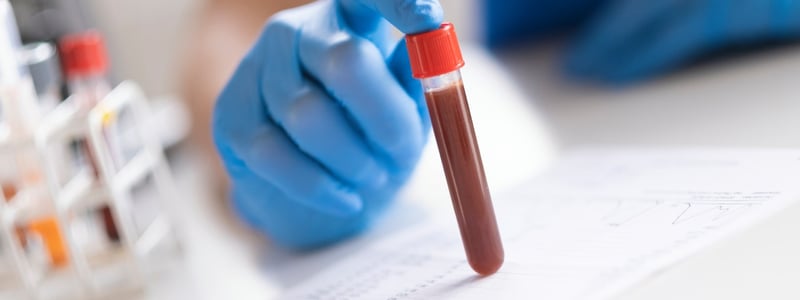 Blutprobe in Probenröhrchen für Laboranalyse.