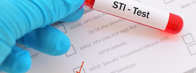 Labor Hand mit Handschuh hält Blutprobe im Röhrchen, dieses ist beschriftet mit STI-Test.