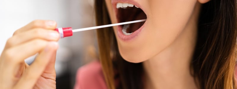 Frau macht mit Stäbchen einen Wangenabstrich. Aus dem biologischen Material kann eine Typisierung für Stammzellspenden erfolgen.