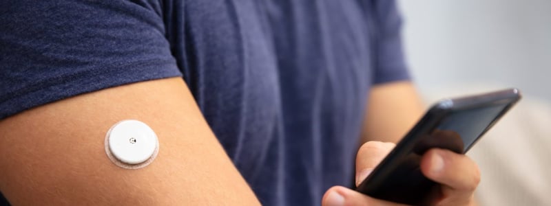 Auf dem Oberarm eines Mannes klebt ein Messgerät, welches auf dem Smartphone den Blutzuckerspiegel zeigen kann.