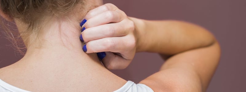 Frau kratz sich im Nacken. Jucken und Rötungen können durch Neurodermitis verursacht werden.